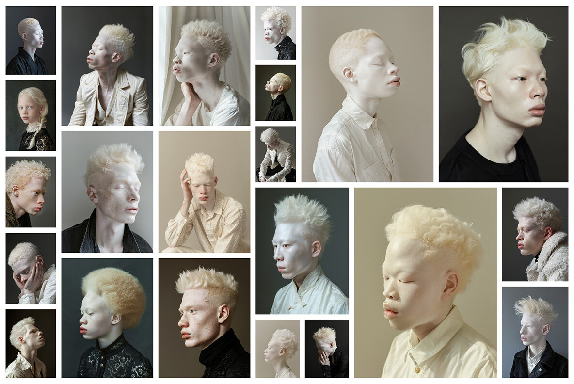 Albinos 5