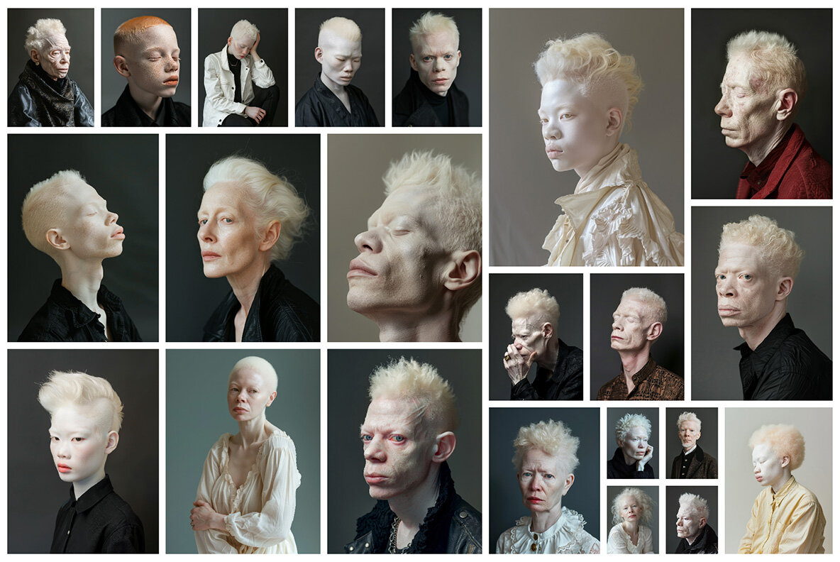 Albinos 7