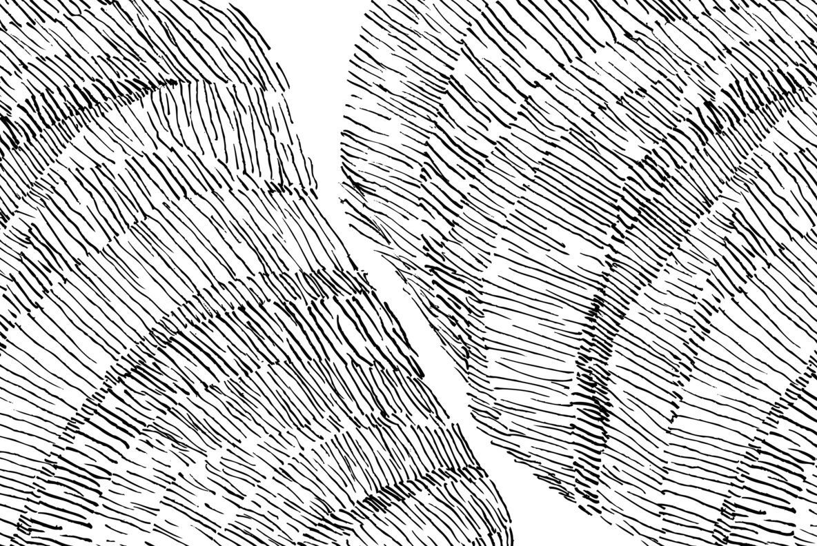Carpal Tunnel 16 Carpal Tunnel 16