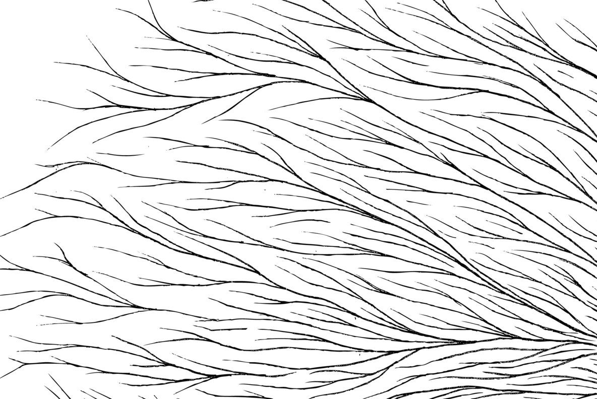 Carpal Tunnel 16 Carpal Tunnel 16