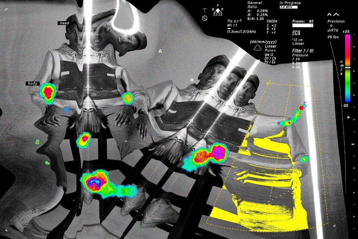 Echo Scan Distortion Effect 1