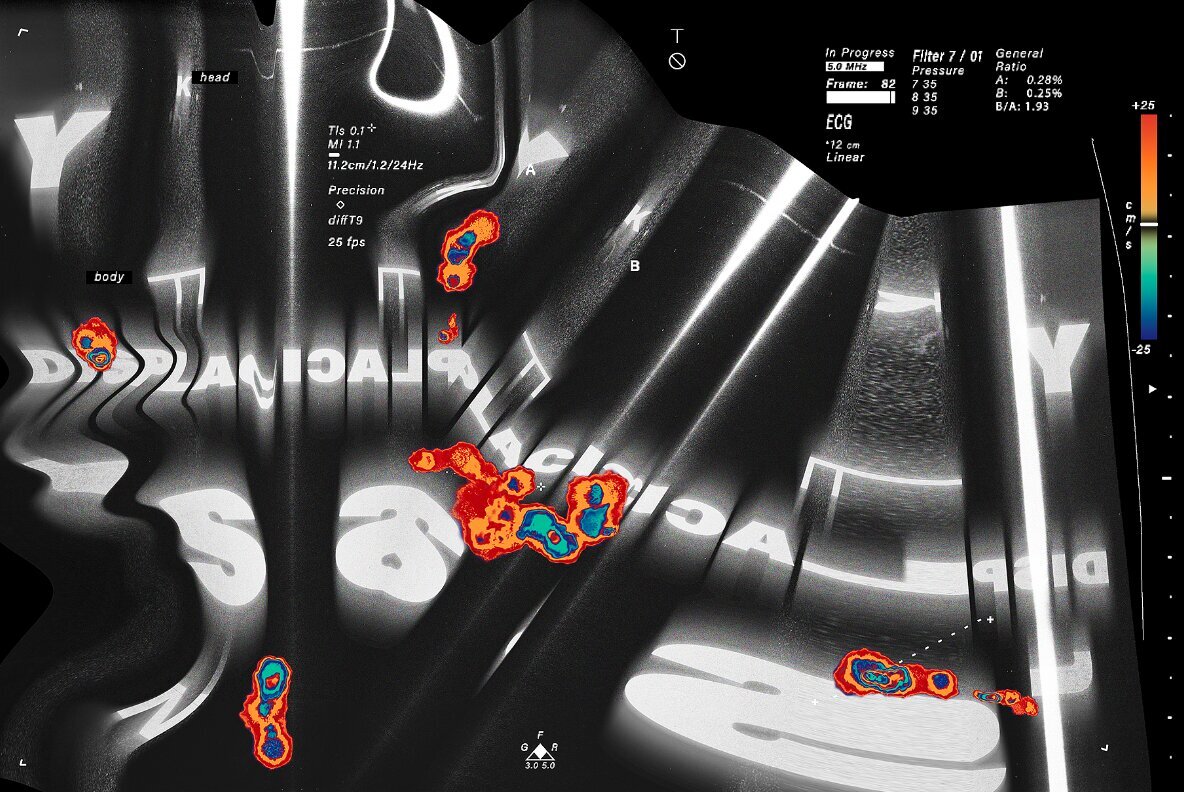Echo Scan Distortion Effect 6