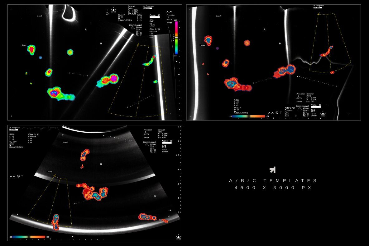 Echo Scan Distortion Effect 7