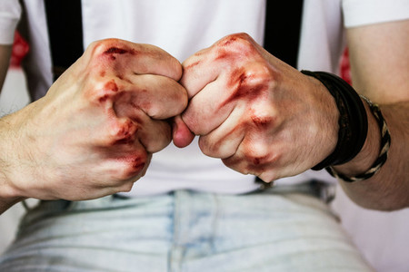 man039 s hands with blood