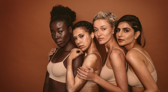 Young women with different skin types