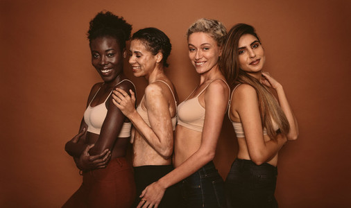Female models with different skins