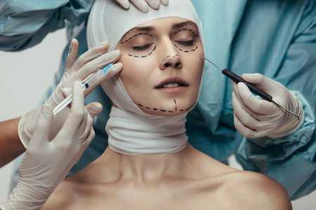 Facial cosmetic surgery