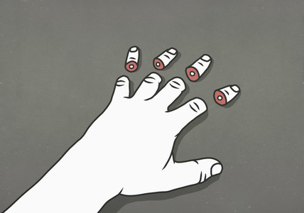 Man with severed fingertips 01
