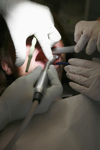 Close up woman receiving teeth cleaning in dentist office
