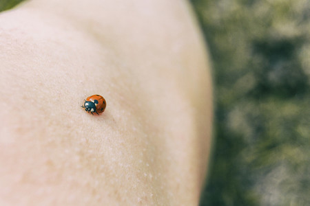 little ladybug perched on the skin of a girls knee