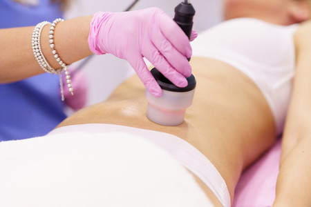 Woman receiving anti cellulite treatment with radiofrequency machine in a beauty center