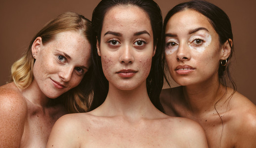 Close up of women with diverse skin types