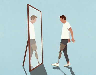 Male amputee with prosthetic limb standing at mirror