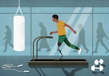 Male amputee with prosthetic leg jogging on treadmill