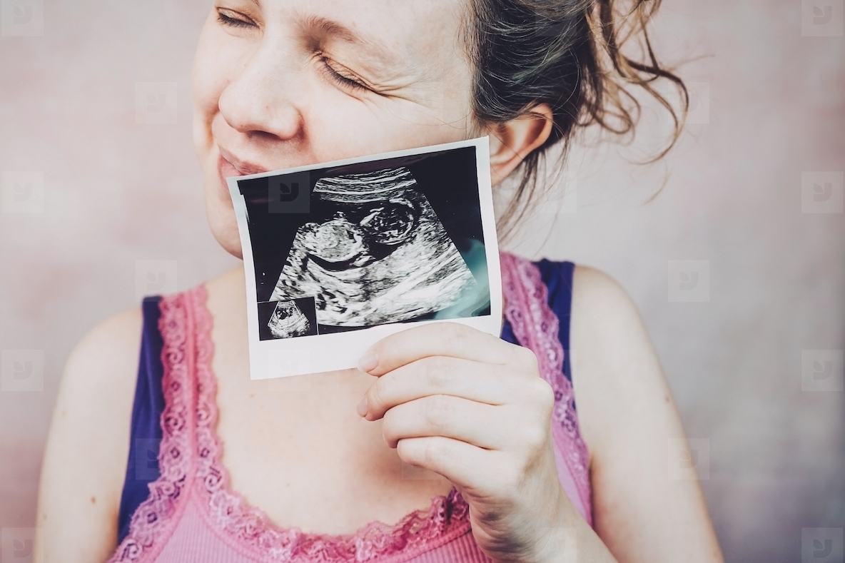 Woman holding the ultrasound of her baby
