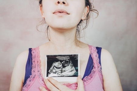 Woman holding the ultrasound of her baby