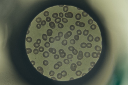 View from above blood sample under microscope