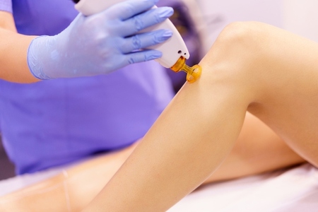 Woman receiving legs laser hair removal at a beauty center