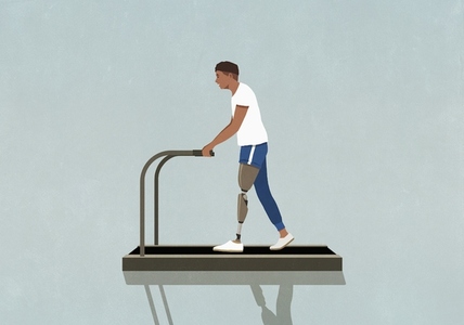 Amputee man with prosthetic leg exercising walking on treadmill