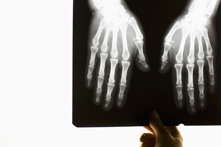 Hand of healthcare professional holding x ray of a pair hands