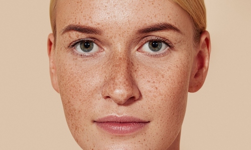 Close up studio shot of a young female with freckles  Portrait of natural beauty woman with smooth skin against pastel backdrop