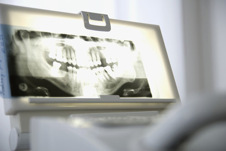 Dental Devices 05